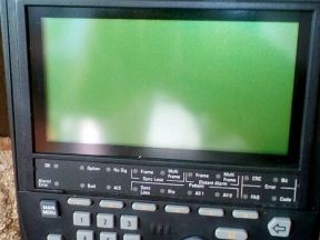 Прибор для измерения Е1 потоков Acterna EST-125